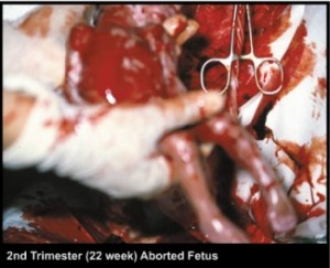 Esto es lo que pone a la izquierda y a las feministas radicales.