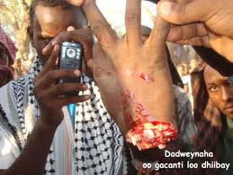 La imagen procede de una "sesión de justicia islámica" somalí.
