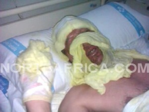 bdelkaber Belghazi se repone de sus heridas en el hospital comarcal de Melilla (foto cedida por norteafrica.com).