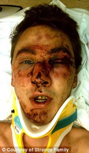 Estado en el que quedó una d las víctimas noruegas de la violencia que asola el país