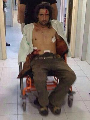 Foto del presunto agresor a su llegada al hospital publicada en Twitter.