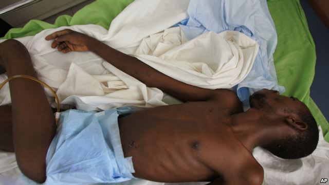 Enfermo de sida es atendido en un hospital en Dakar, Senegal.