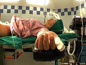 Un paciente entubado antes de una operación de cambio de sexo. 