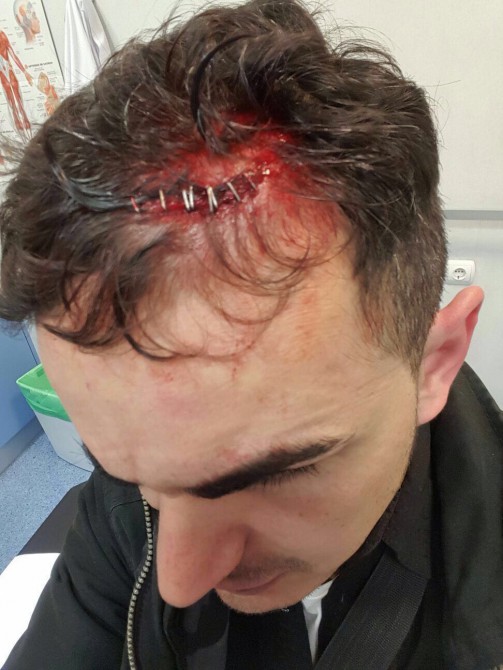 Imagen de uno de los policías heridos hecha pública por Alfredo Perdiguero