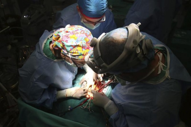 Un cirujano y su equipo durante un trasplante de corazón. 