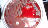 La bacteria Elizabethkingia, que ha tenido un raro brote en Wisconsin y Michigan durante 2016. (Wikimedia Commons)
