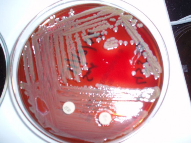 La bacteria Elizabethkingia, que ha tenido un raro brote en Wisconsin y Michigan durante 2016. (Wikimedia Commons)
