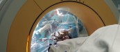 Un momento de una operación pionera realizada en España en cirugía para Parkinson realizada con TAC intraoperatorio en el hospital La Fe de Valencia.