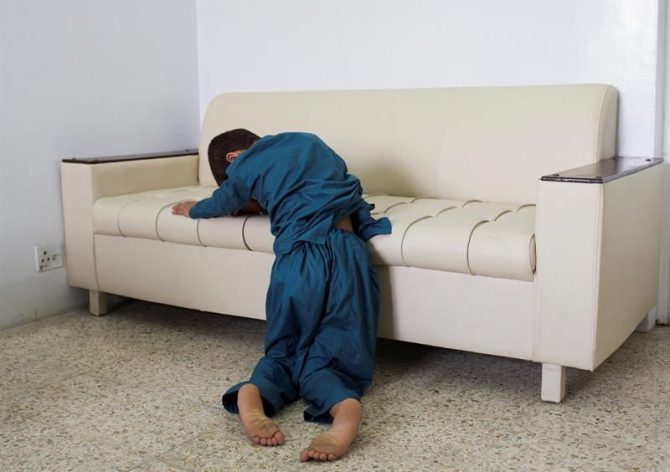 Uno de los dos hermanos paquistaníes conocidos como los "niños solares", un caso que ha dejado perplejos a los médicos del país asiático, que buscan soluciones para esta extraña enfermedad.