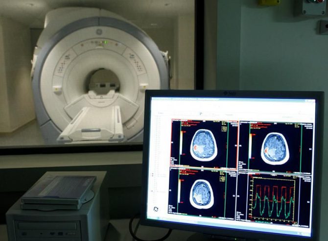 Vista de una sala de escáner del Centro Alzheimer, impulsado por la Fundación Reina Sofía en Madrid.