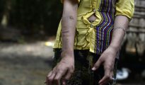 San Kay Khine, una adolescente de 17 años, muestra las cicatrices que tiene en sus brazos el 20 de septiembre de 2016 en la localidad birmana de Baw Lone Kwin