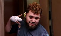 La mitad de la oreja de Ortiz fue encontrada por la policía en la habitación que compartía con su amigo, por lo que pudo ser reimplantada.