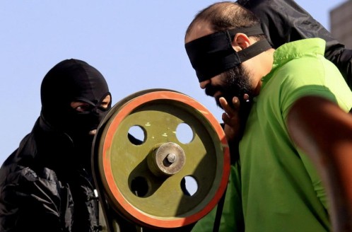 Imagen de archivo de la amputación de los dedos a un condenado por robo según la ley islámica