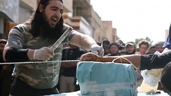 Generalmente, las amputaciones se realizan a personas acusadas de robo