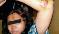 Noorjahan fue gravemente herida y torturada por su amo sexual