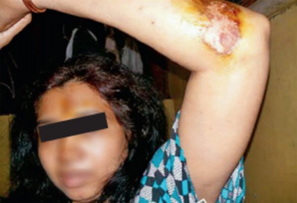 Noorjahan fue gravemente herida y torturada por su amo sexual