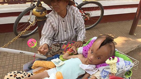 Pheaktra Pov, con su abuela, en la puerta del templo donde pide donaciones para su tratamiento.