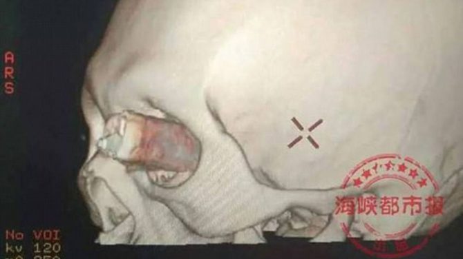 El joven declaró que su mujer lo había apuñalado luego de una discusión