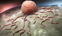 Una célula cancerígena vista al detalle