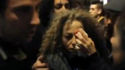 Ester Quintana, que perdió un ojo tras ser alcanzada en noviembre de 2012 pro una bala de goma