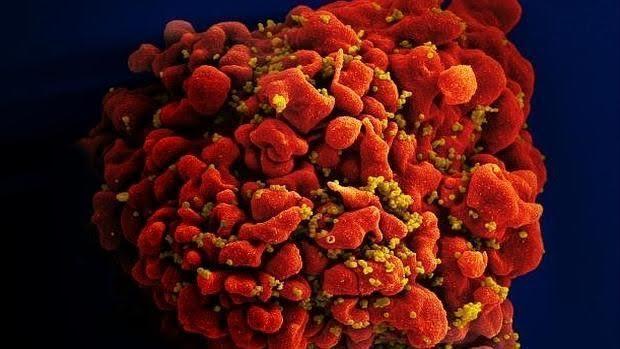 Célula infectada por el VIH