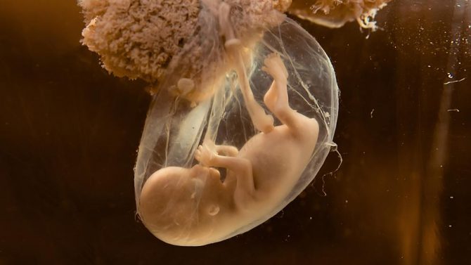 Embrión humano.