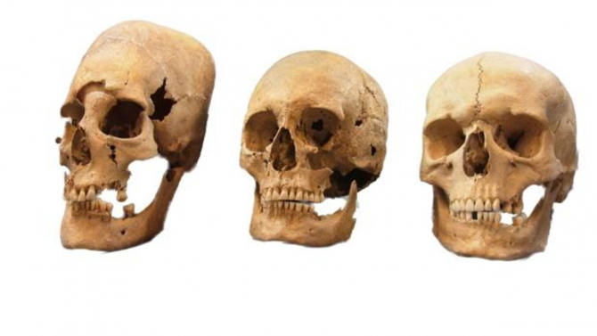 Cráneos con distinto estado de alteración. Se vendaba la cabeza de las niñas para cambiar su forma, como señal de alto nivel socioeconómico - State Collection for Anthropology and Palaeoanatomy Munich