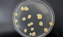 Imagen de archivo de un cultivo de Mycobacterium tuberculosis, la bacteria que causa esta enfermedad infecciosa