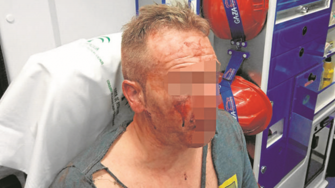 El policía agredido en Córdoba (ABC)