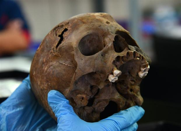 Levantamiento del cráneo del individuo - Instituto Nacional de Antropología e Historia (INAH)