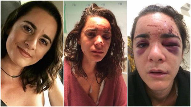 A la izda, una foto publicada en su cuenta de Instagram; en las otras, las imagenes divulgadas en Facebook por Andrea tras la brutal agresión 