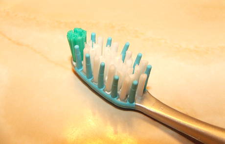 La periodontitis puede prevenirse con una correcta higiene bucodental.