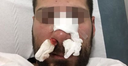 Imagen del policía tras la paliza - ABC